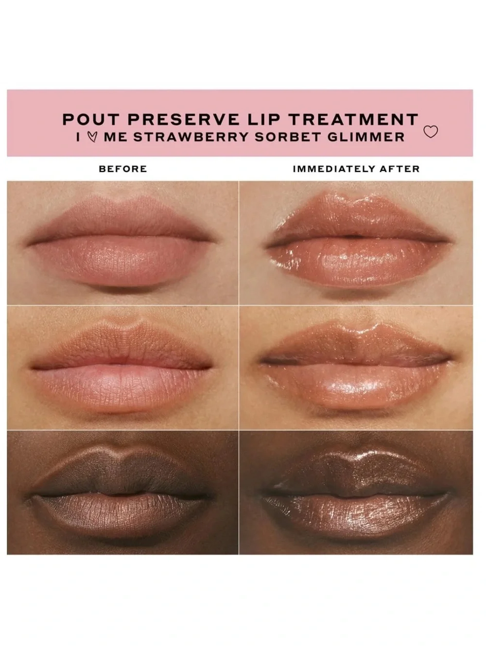 Olehenriksen x Anine Bing 'I Love Me' Pout Preserve Peptide Lip Treatment New